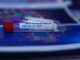 Swann announces expansion of asymptomatic testing | Newry Times Coronavirus Covid19 Newry news
