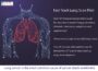 Southern Trust Lung Pilot - Newry online